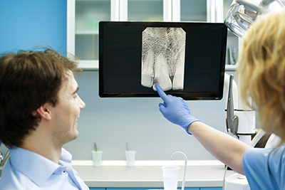 San Antonio cosmetic dentist showing patient digital X-Rays at Excellent Dental Specialists.