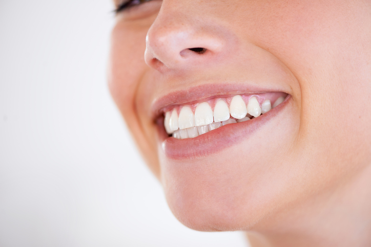 Dental bonding service is offered at Excellent Dental Specialists located in San Antonio, TX.