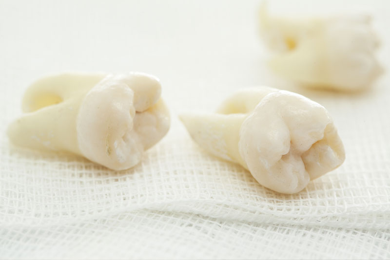 Dental Tooth Model