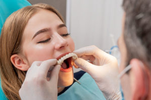 an image of a patient getting her dental prosthetic placed in her mouth by a doctor after the dental implants have been placed with a CBCT scan.