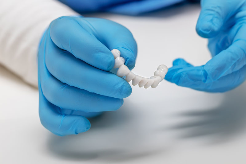 an image of a periodontist holding a dental prosthetic before placing it in a patients mouth for their dental implant procedure.
